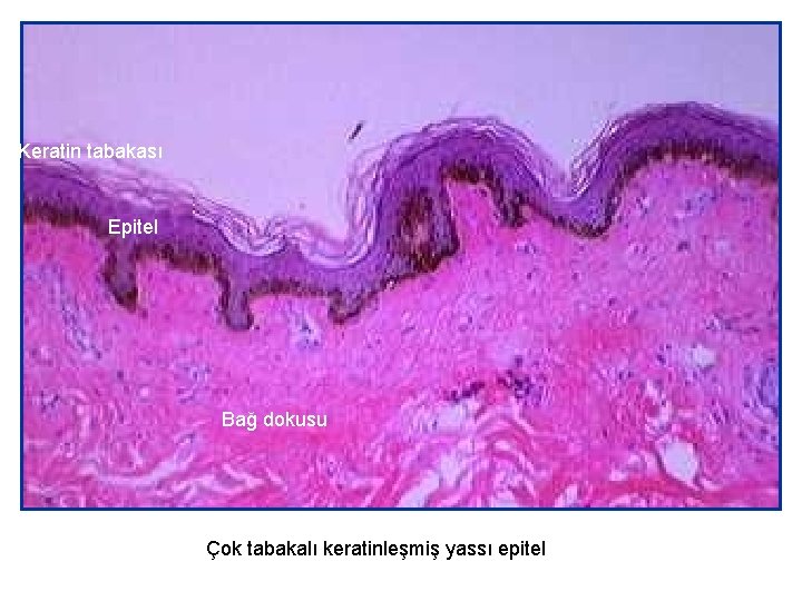 Keratin tabakası Epitel Bağ dokusu Çok tabakalı keratinleşmiş yassı epitel 