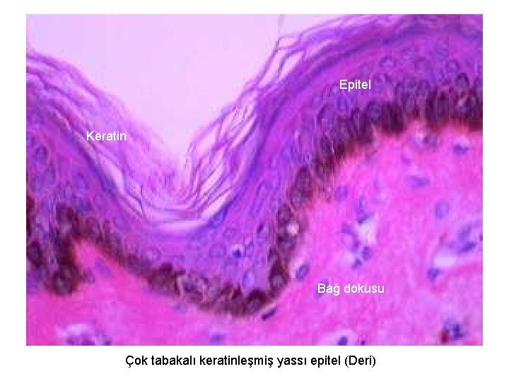 Epitel Keratin Bağ dokusu Çok tabakalı keratinleşmiş yassı epitel (Deri) 