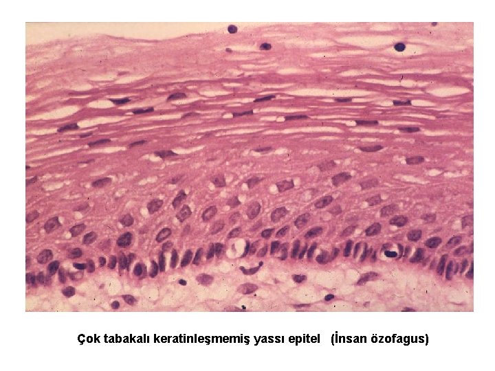 Çok tabakalı keratinleşmemiş yassı epitel (İnsan özofagus) 