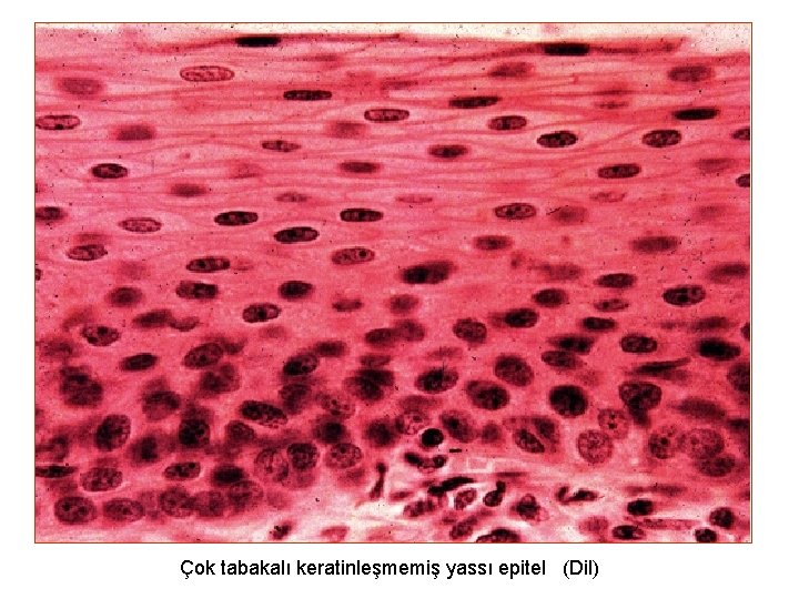 Çok tabakalı keratinleşmemiş yassı epitel (Dil) 