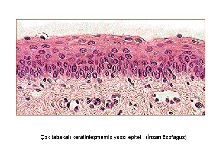 Çok tabakalı keratinleşmemiş yassı epitel (İnsan özofagus) 