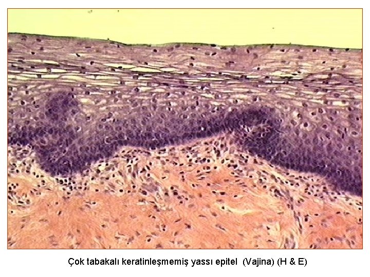 Çok tabakalı keratinleşmemiş yassı epitel (Vajina) (H & E) 