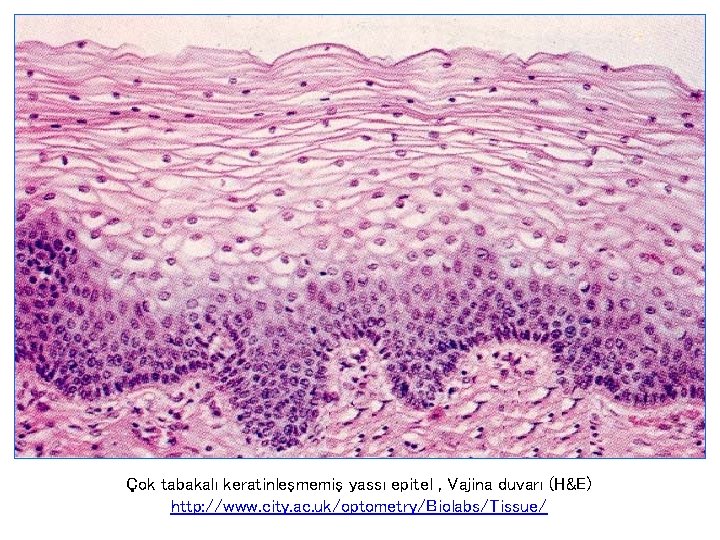 Çok tabakalı keratinleşmemiş yassı epitel , Vajina duvarı (H&E) http: //www. city. ac. uk/optometry/Biolabs/Tissue/