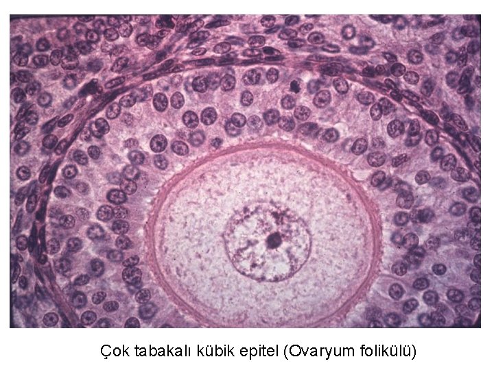 Çok tabakalı kübik epitel (Ovaryum folikülü) 