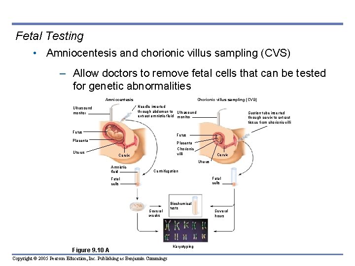 Fetal Testing • Amniocentesis and chorionic villus sampling (CVS) – Allow doctors to remove