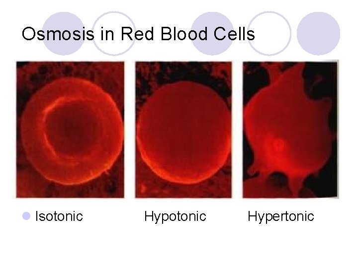 Osmosis in Red Blood Cells l Isotonic Hypertonic 