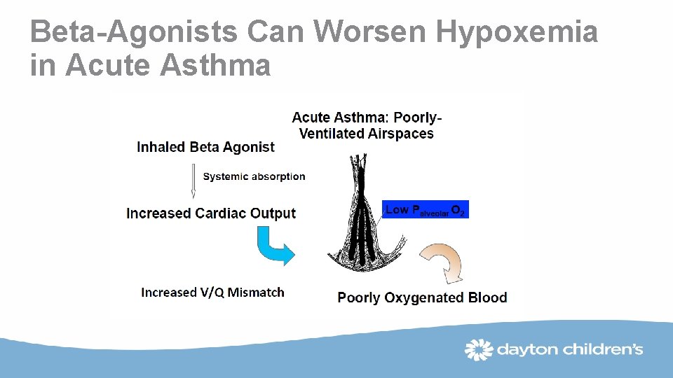 Beta-Agonists Can Worsen Hypoxemia in Acute Asthma 