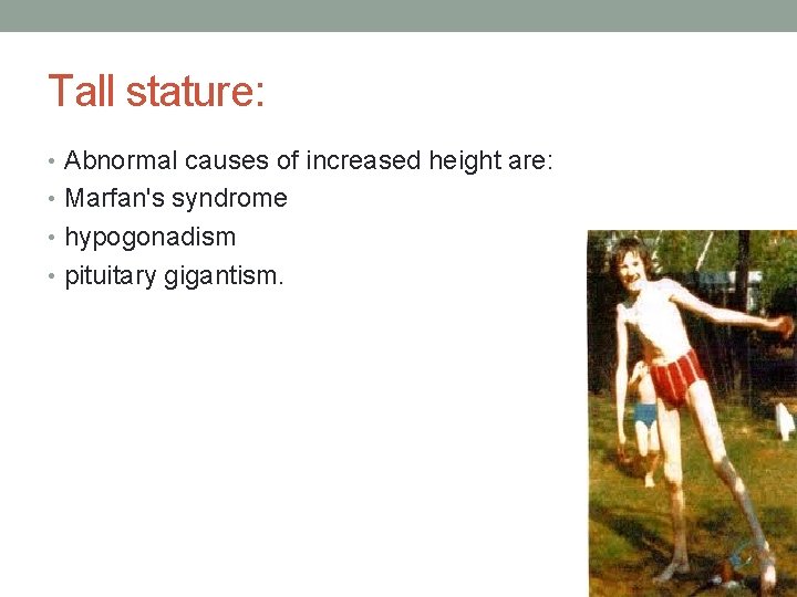 Tall stature: • Abnormal causes of increased height are: • Marfan's syndrome • hypogonadism