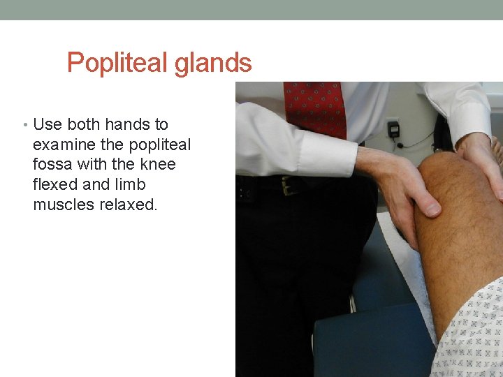 Popliteal glands • Use both hands to examine the popliteal fossa with the knee