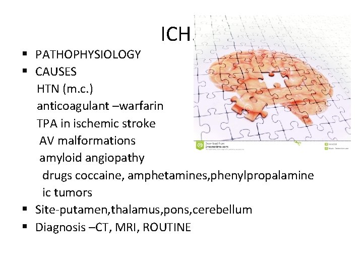 ICH. . § PATHOPHYSIOLOGY § CAUSES HTN (m. c. ) anticoagulant –warfarin TPA in ICH. . § PATHOPHYSIOLOGY § CAUSES HTN (m. c. ) anticoagulant –warfarin TPA in