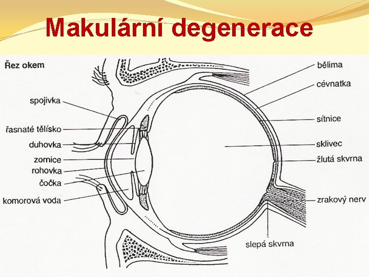 Makulární degenerace 