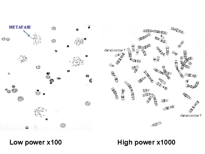 METAFASE Low power x 100 High power x 1000 