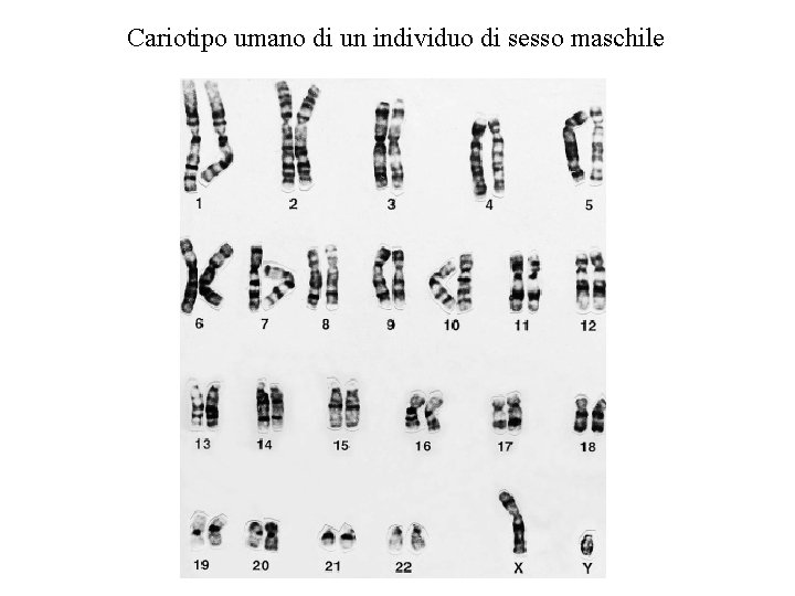 Cariotipo umano di un individuo di sesso maschile 