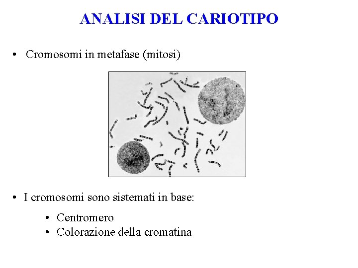 ANALISI DEL CARIOTIPO • Cromosomi in metafase (mitosi) • I cromosomi sono sistemati in