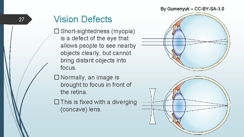 By Gumenyuk – CC-BY-SA-3. 0 27 Vision Defects � Short-sightedness (myopia) is a defect