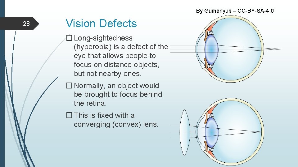 By Gumenyuk – CC-BY-SA-4. 0 28 Vision Defects � Long-sightedness (hyperopia) is a defect