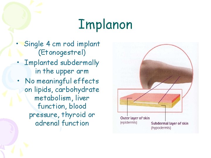 Implanon • Single 4 cm rod implant (Etonogestrel) • Implanted subdermally in the upper