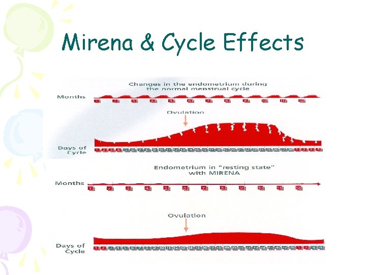 Mirena & Cycle Effects 