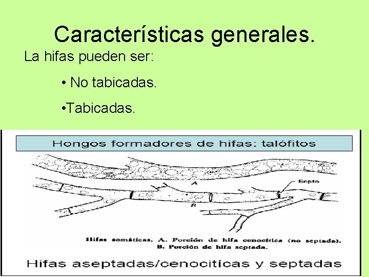 Características generales. La hifas pueden ser: • No tabicadas. • Tabicadas. 