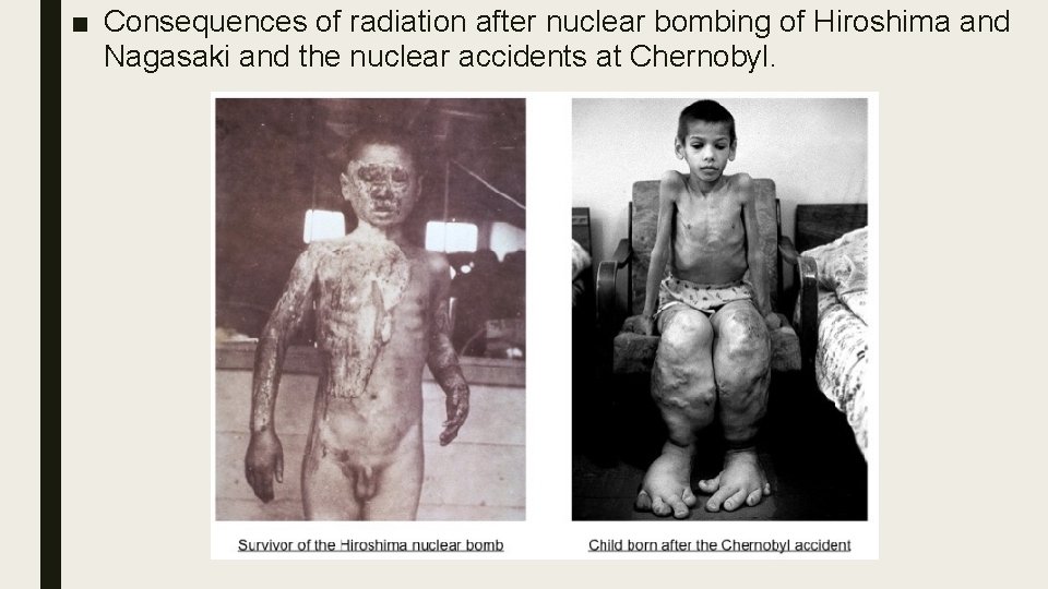 ■ Consequences of radiation after nuclear bombing of Hiroshima and Nagasaki and the nuclear
