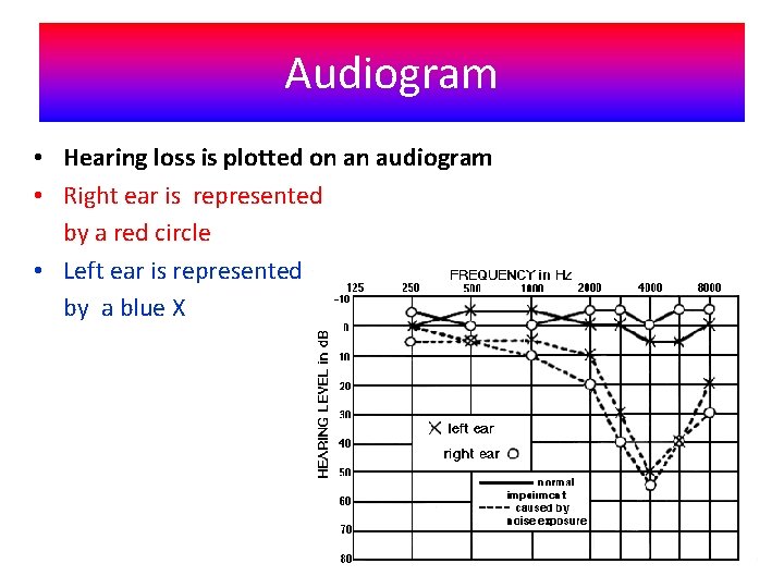 Audiogram • Hearing loss is plotted on an audiogram • Right ear is represented