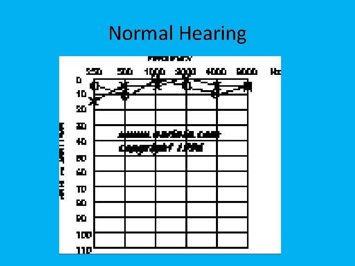 Normal Hearing 