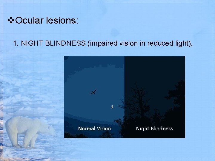v. Ocular lesions: 1. NIGHT BLINDNESS (impaired vision in reduced light). 