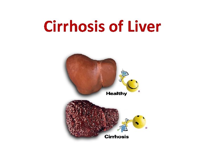 Cirrhosis of Liver Cirrhosis of Liver