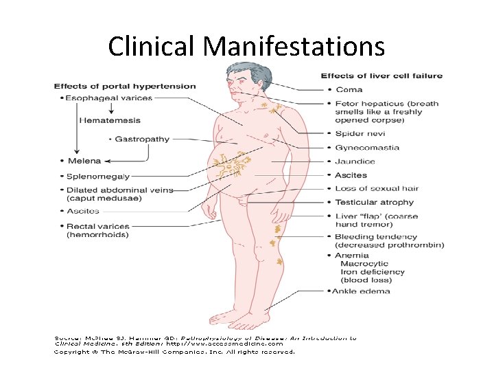 Clinical Manifestations Clinical Manifestations