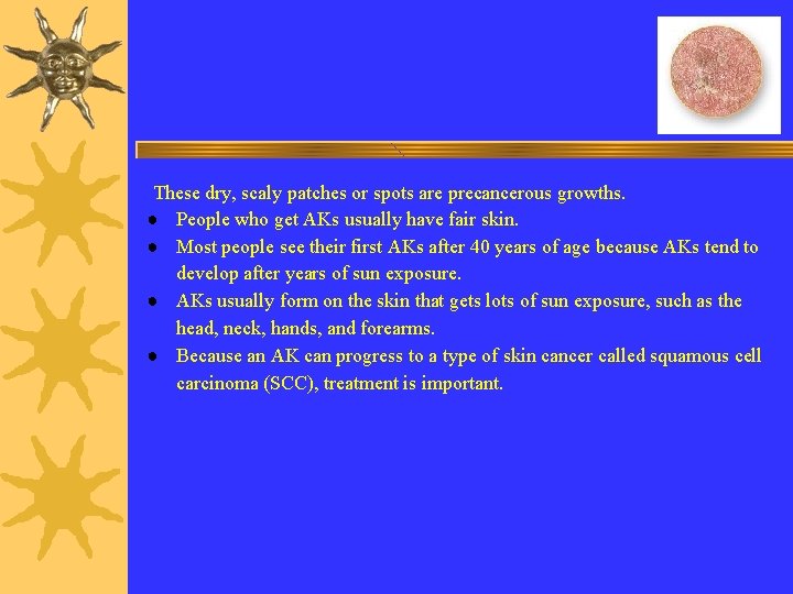 These dry, scaly patches or spots are precancerous growths. ● People who get AKs