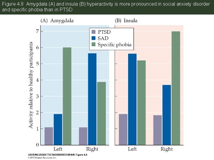 Figure 4. 8 Amygdala (A) and insula (B) hyperactivity is more pronounced in social