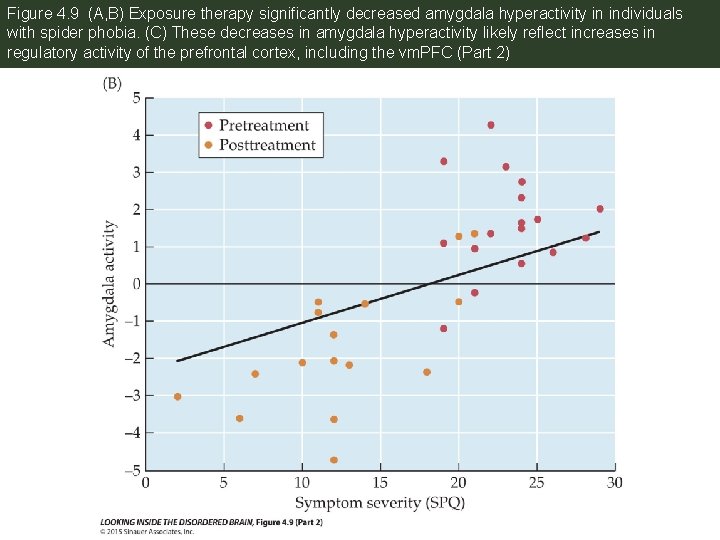 Figure 4. 9 (A, B) Exposure therapy significantly decreased amygdala hyperactivity in individuals with