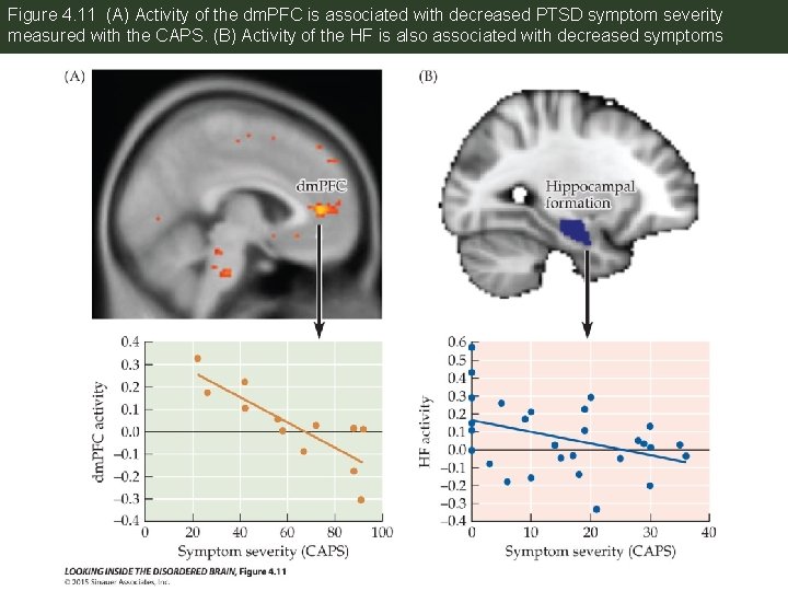 Figure 4. 11 (A) Activity of the dm. PFC is associated with decreased PTSD