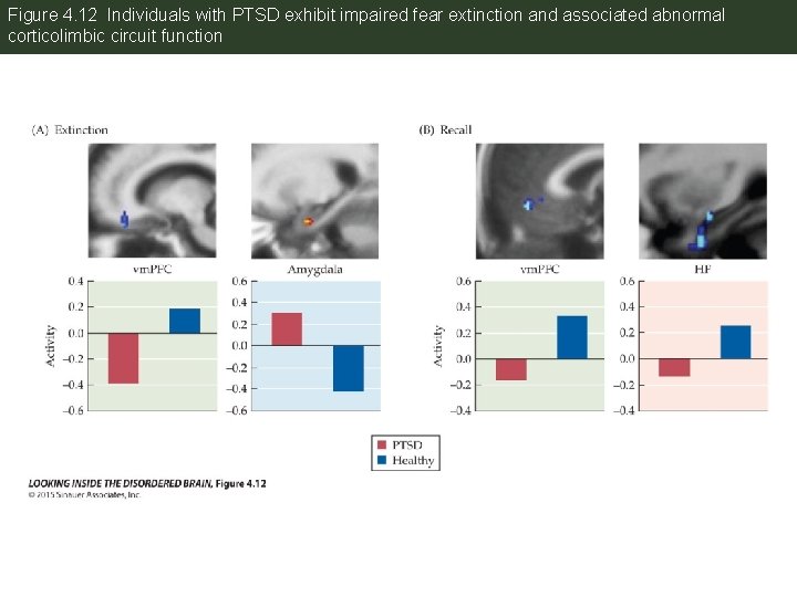 Figure 4. 12 Individuals with PTSD exhibit impaired fear extinction and associated abnormal corticolimbic