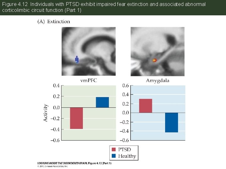Figure 4. 12 Individuals with PTSD exhibit impaired fear extinction and associated abnormal corticolimbic