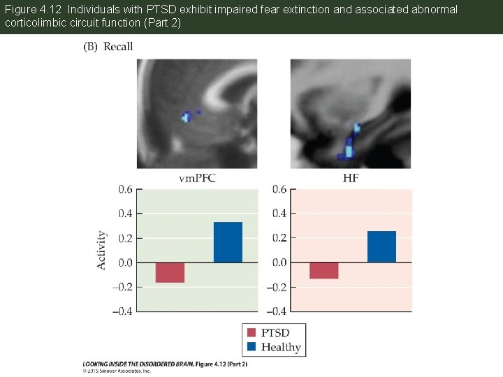 Figure 4. 12 Individuals with PTSD exhibit impaired fear extinction and associated abnormal corticolimbic