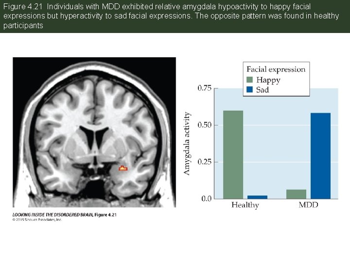 Figure 4. 21 Individuals with MDD exhibited relative amygdala hypoactivity to happy facial expressions
