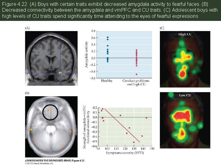 Figure 4. 22 (A) Boys with certain traits exhibit decreased amygdala activity to fearful