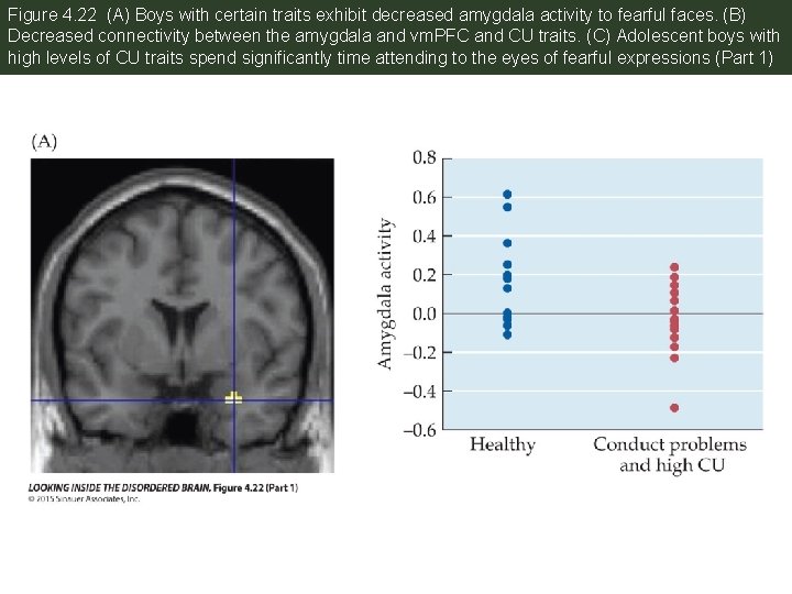 Figure 4. 22 (A) Boys with certain traits exhibit decreased amygdala activity to fearful