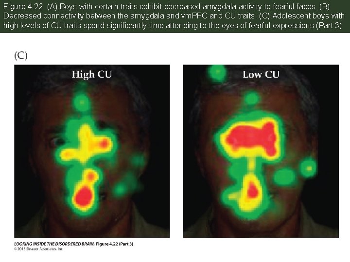 Figure 4. 22 (A) Boys with certain traits exhibit decreased amygdala activity to fearful