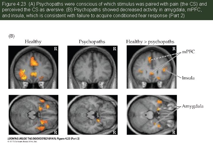 Figure 4. 23 (A) Psychopaths were conscious of which stimulus was paired with pain