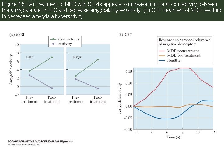 Figure 4. 5 (A) Treatment of MDD with SSRIs appears to increase functional connectivity