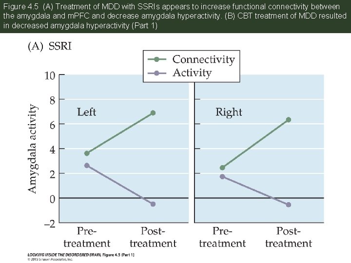 Figure 4. 5 (A) Treatment of MDD with SSRIs appears to increase functional connectivity