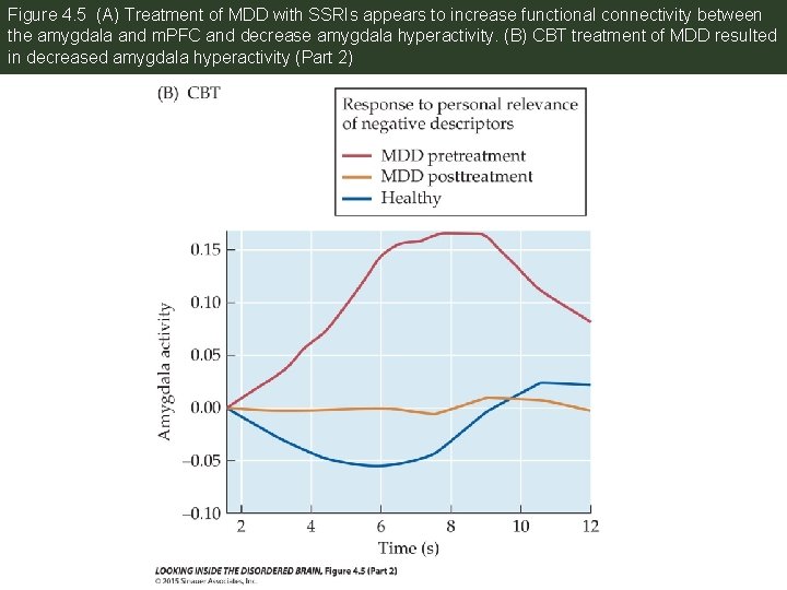 Figure 4. 5 (A) Treatment of MDD with SSRIs appears to increase functional connectivity