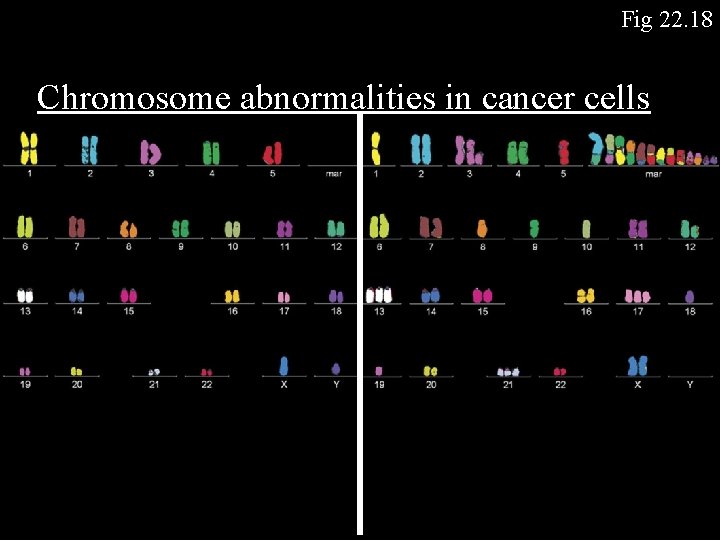 Fig 22. 18 Chromosome abnormalities in cancer cells 