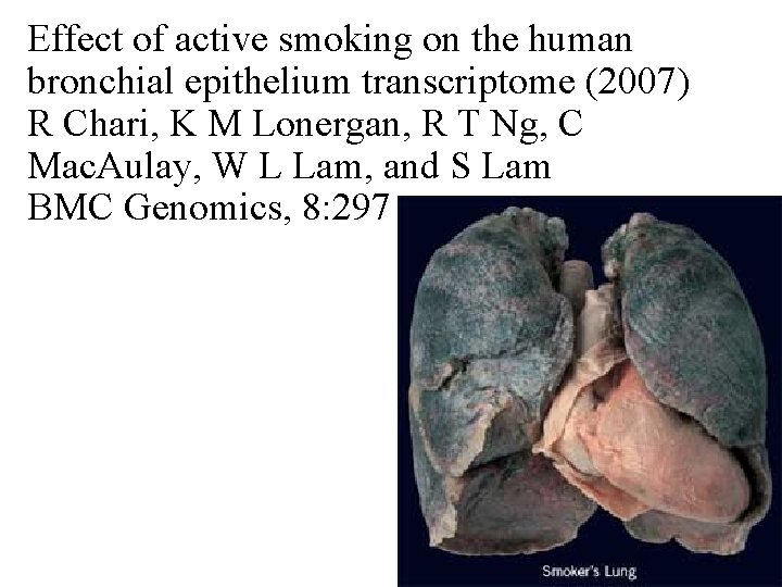 Effect of active smoking on the human bronchial epithelium transcriptome (2007) R Chari, K