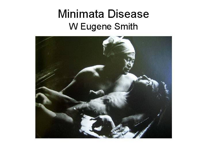 Minimata Disease W Eugene Smith 