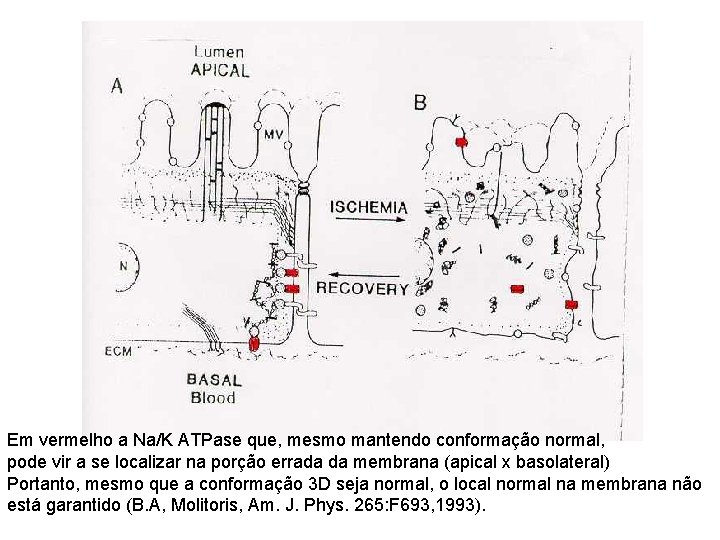 Em vermelho a Na/K ATPase que, mesmo mantendo conformação normal, pode vir a se