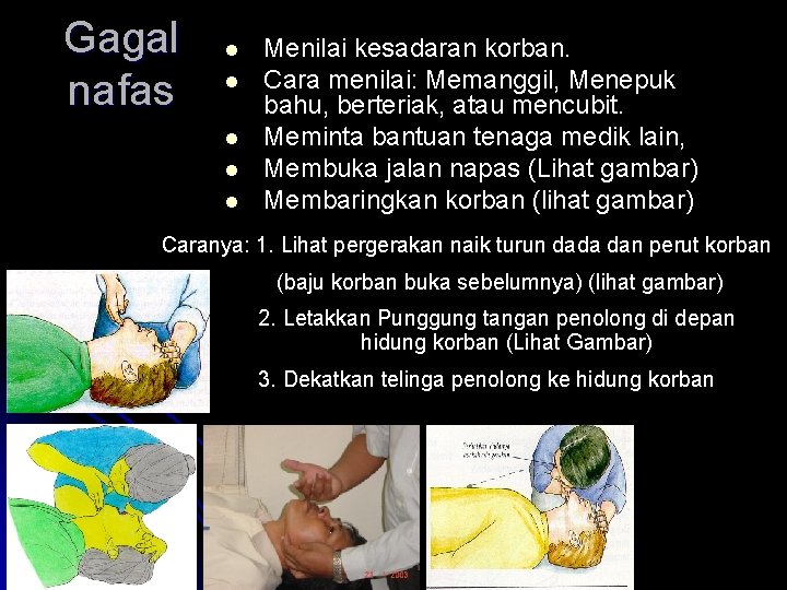 Gagal nafas l l l Menilai kesadaran korban. Cara menilai: Memanggil, Menepuk bahu, berteriak,