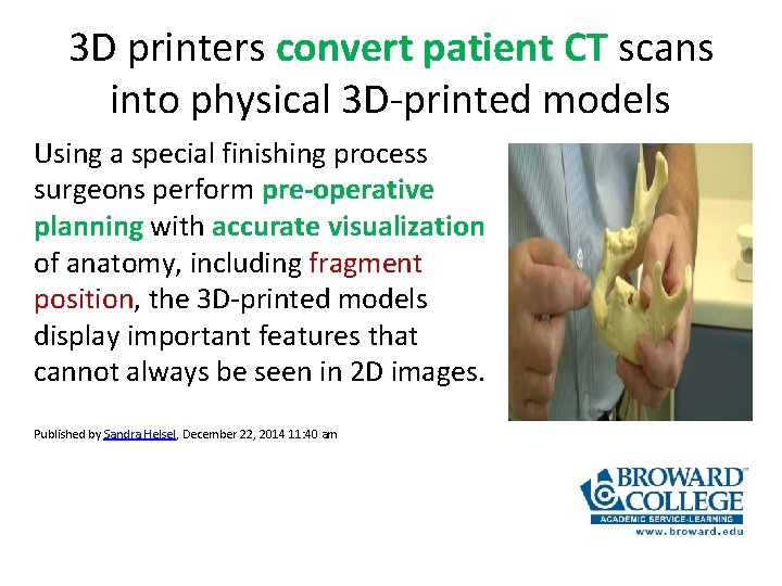 3 D printers convert patient CT scans into physical 3 D-printed models Using a